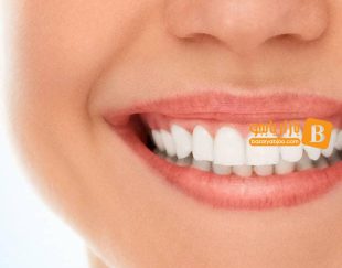 بازاریاب حرفه‌ای برای دندانپزشکی زیبایی